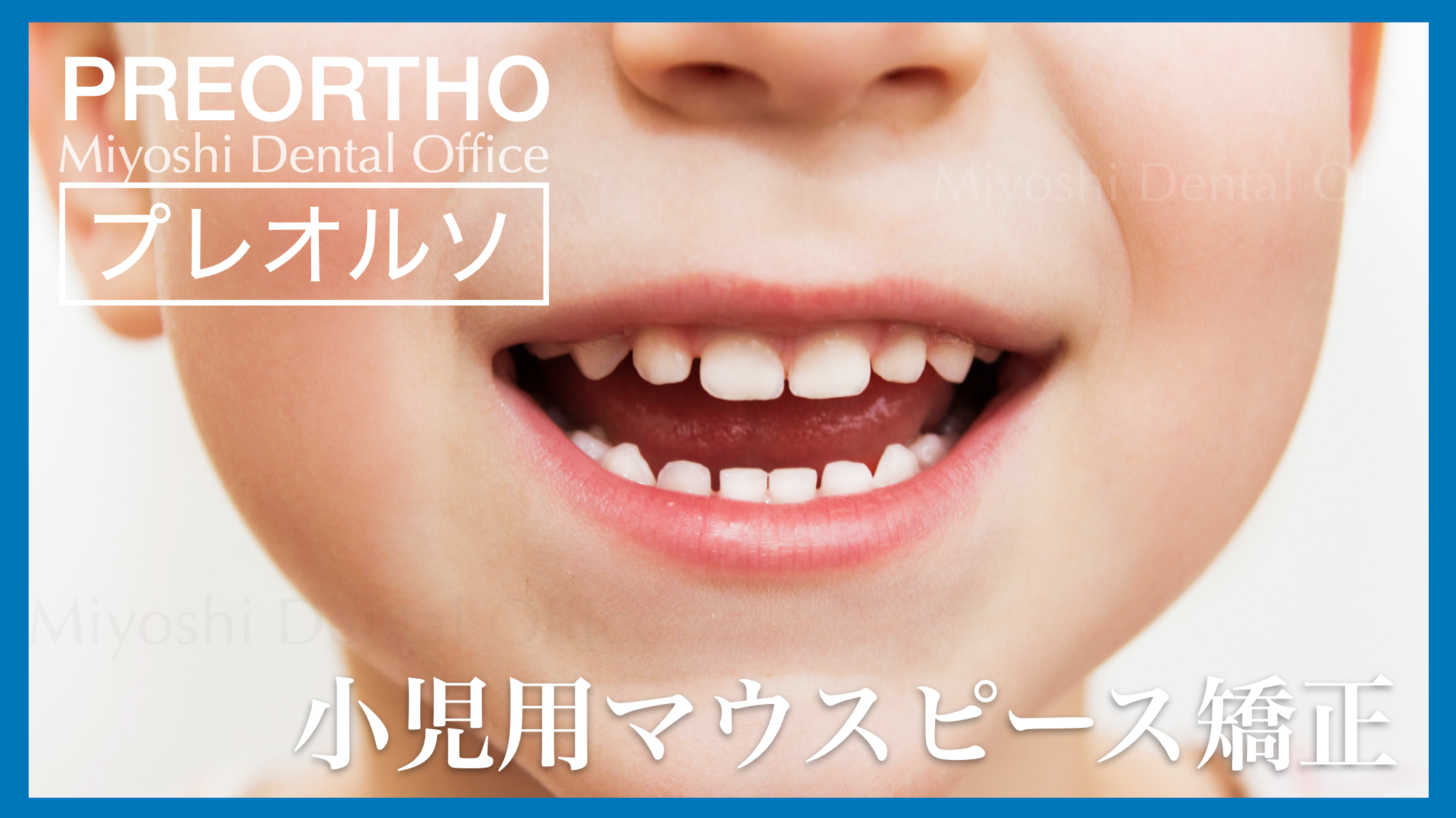 小児のマウスピース矯正 みよし歯科医院公式サイト3 小児のマウスピース矯正 みよし歯科医院公式サイト3